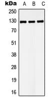 Polyclonal Rabbit anti-Human LATS1 Antibody (C-Terminus, WB)