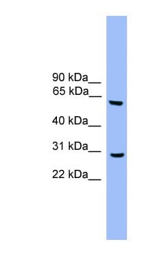 APG5 / ATG5 Antibody (aa161-210, Biotin)
