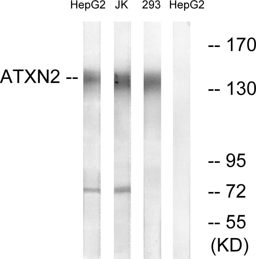 Polyclonal Rabbit anti-Human ATXN2 / SCA2 / Ataxin-2 Antibody (aa731-780, WB)