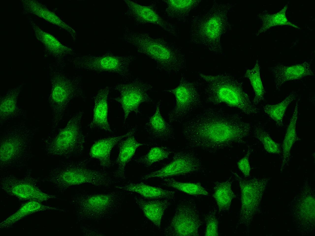 YBX1 / YB1 Antibody (Preservative Free)