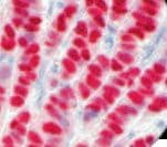 Recombinant Monoclonal Rabbit anti-Human Estrogen Receptor Antibody (clone RBT11, IHC)
