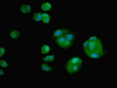 AMH / Anti-Mullerian Hormone Antibody (aa26-560)