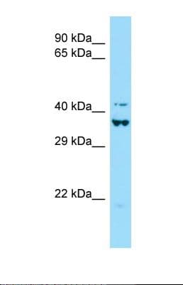 Polyclonal Rabbit anti-Human DEF6 Antibody (aa480-529, WB)