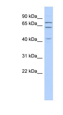 ELF4 / MEF Antibody (aa179-228)