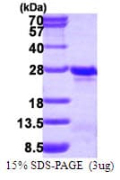 Human TAGLN3 / Neuronal Protein 22 (Recombinant His)