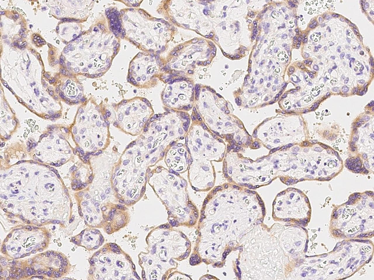 Polyclonal Rabbit anti-Human PRLR / Prolactin Receptor Antibody (Preservative Free, IHC)