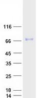 Human SPINT1 / HAI-1 Protein (Recombinant Myc-DDK (Flag))