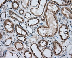 PRKAR2A Antibody (clone OTI1B4)