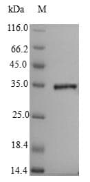 Clostridium botulinum Penicillin-binding protein 1A (Recombinant 6His-SUMO, N-terminus)