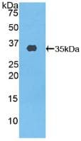 ABCA3 Antibody (aa1358-1635, APC)