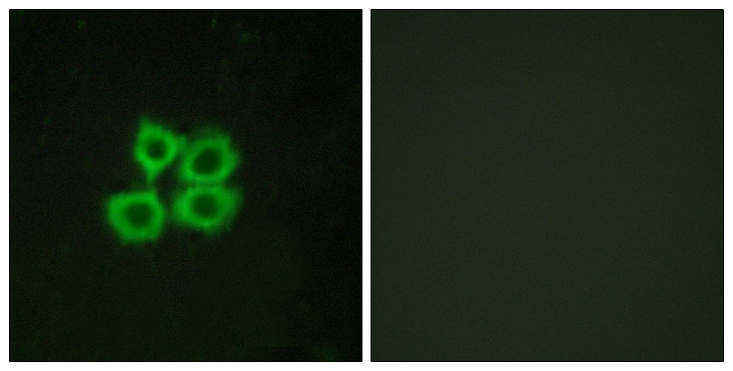 CRHR2 / CRF2 Receptor Antibody