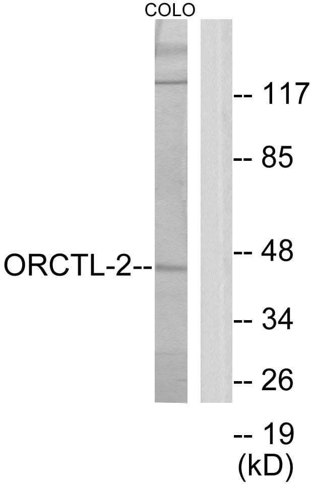 Polyclonal Rabbit anti-Human SLC22A18 Antibody (WB)