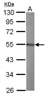 TUBA1A / Tubulin Alpha 1a Antibody (aa37-276)