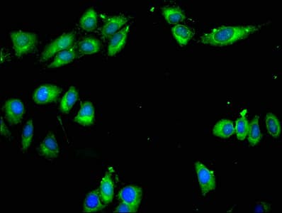 ARPC1A Antibody