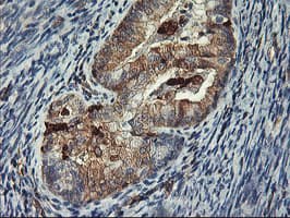 Monoclonal Mouse anti-Human VASP Antibody (clone OTI1F3, IHC, WB)