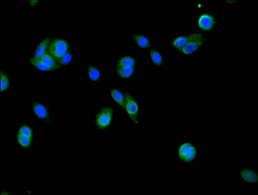 Polyclonal Rabbit anti-Human FSIP2 Antibody (IF)