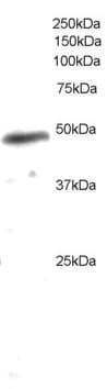 IHC-plus™ Polyclonal Goat anti-Human NCF1 / p47phox / p47 phox Antibody (aa378-390, IHC, IF, WB)