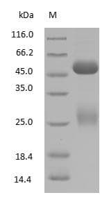 Human IgG Protein (Native)