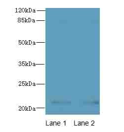 Polyclonal Rabbit anti-Human CDC42 Antibody (WB)