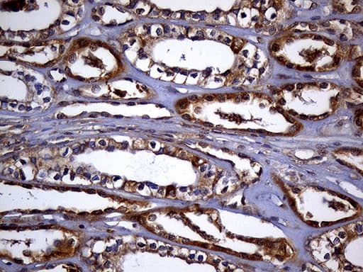 Monoclonal Mouse anti-Human TRXR1 / TXNRD1 Antibody (clone OTI7B2, IHC, WB)