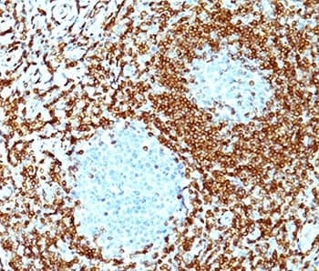 BCL2 / Bcl-2 Antibody (aa41-54, clone 100/D5 + 124, Azide-free, BSA-free)