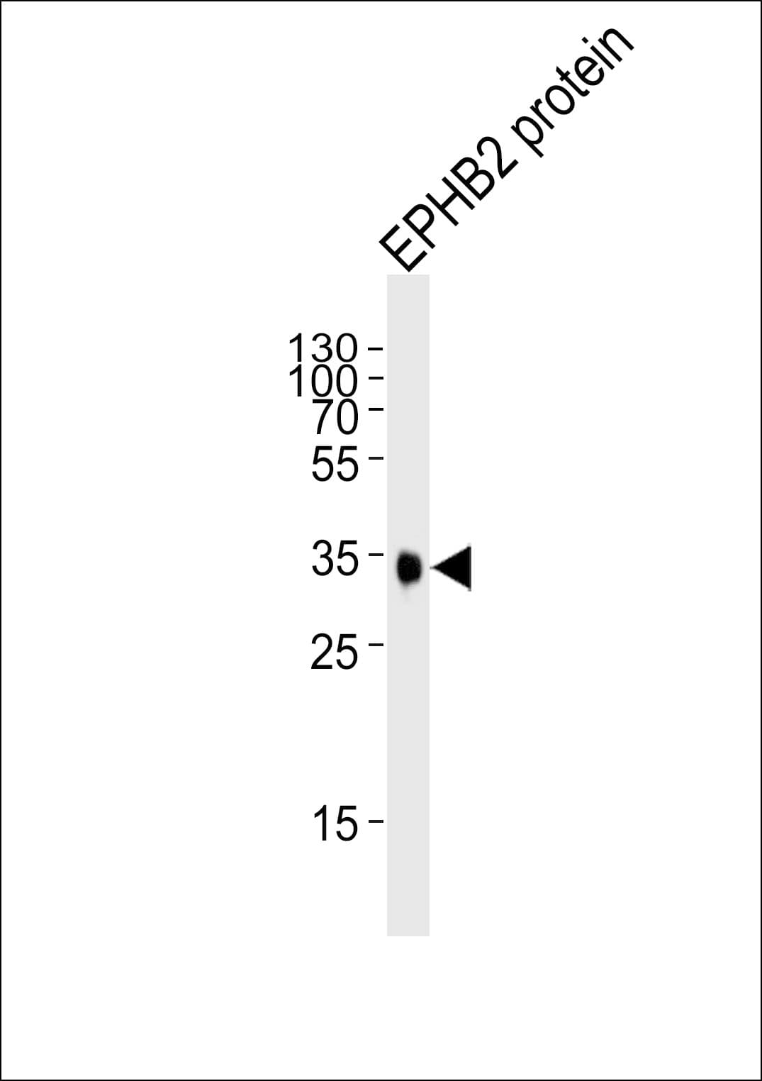 EPHB2 / EPH Receptor B2 Antibody (clone 48CT12.6.4)