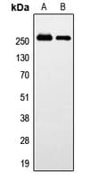 GPR179 Antibody (Internal)