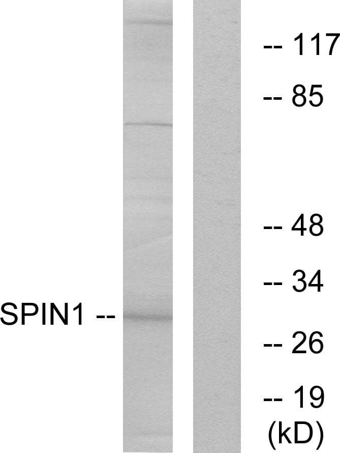 Polyclonal Rabbit anti-Human SPIN / SPIN1 Antibody (WB)