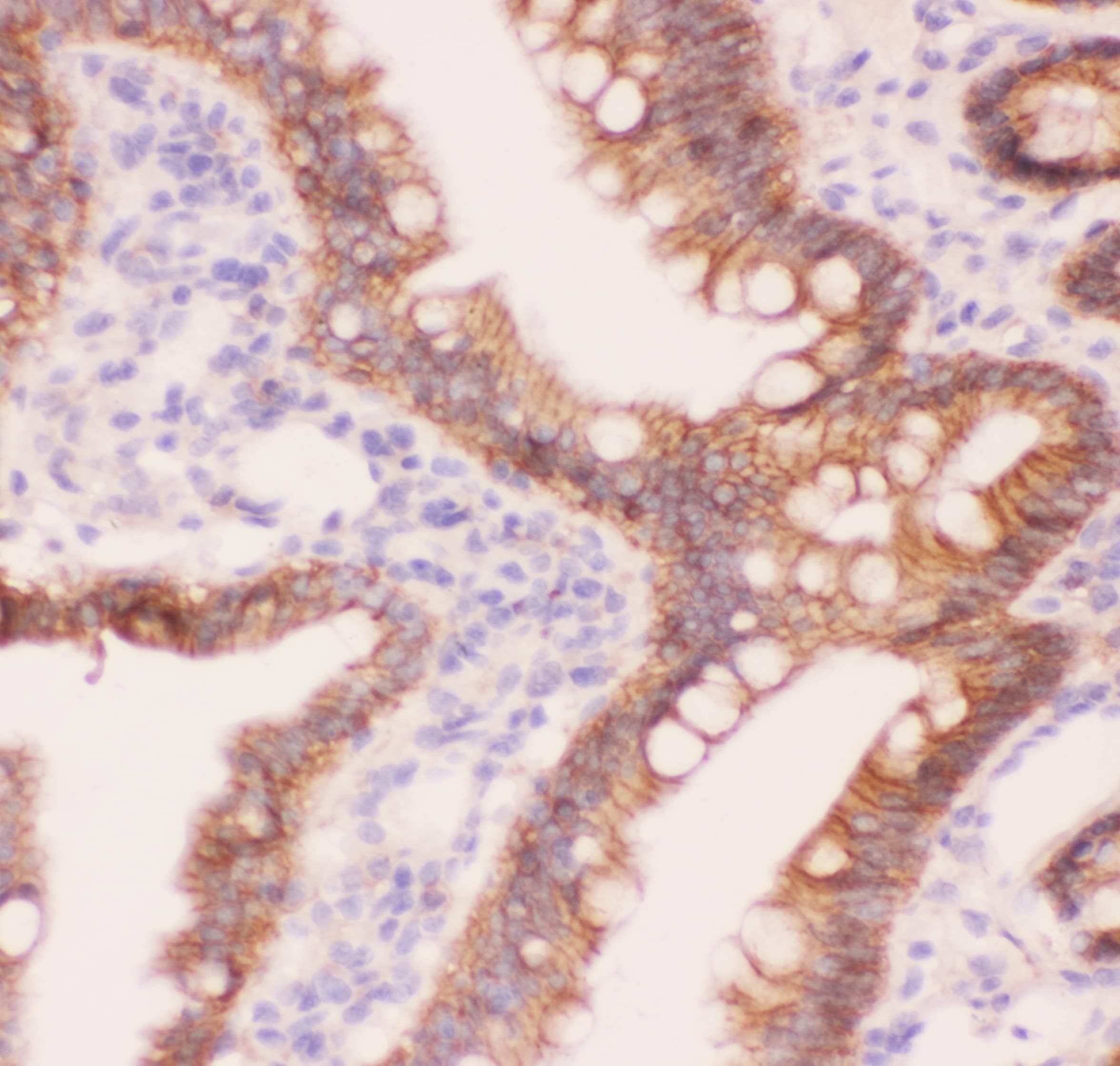 CTNNA1 / Catenin Alpha-1 Antibody (aa143-292)