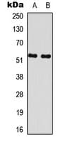 Polyclonal Rabbit anti-Human RPS6KB2 / S6K2 Antibody (C-Terminus, IHC, WB)