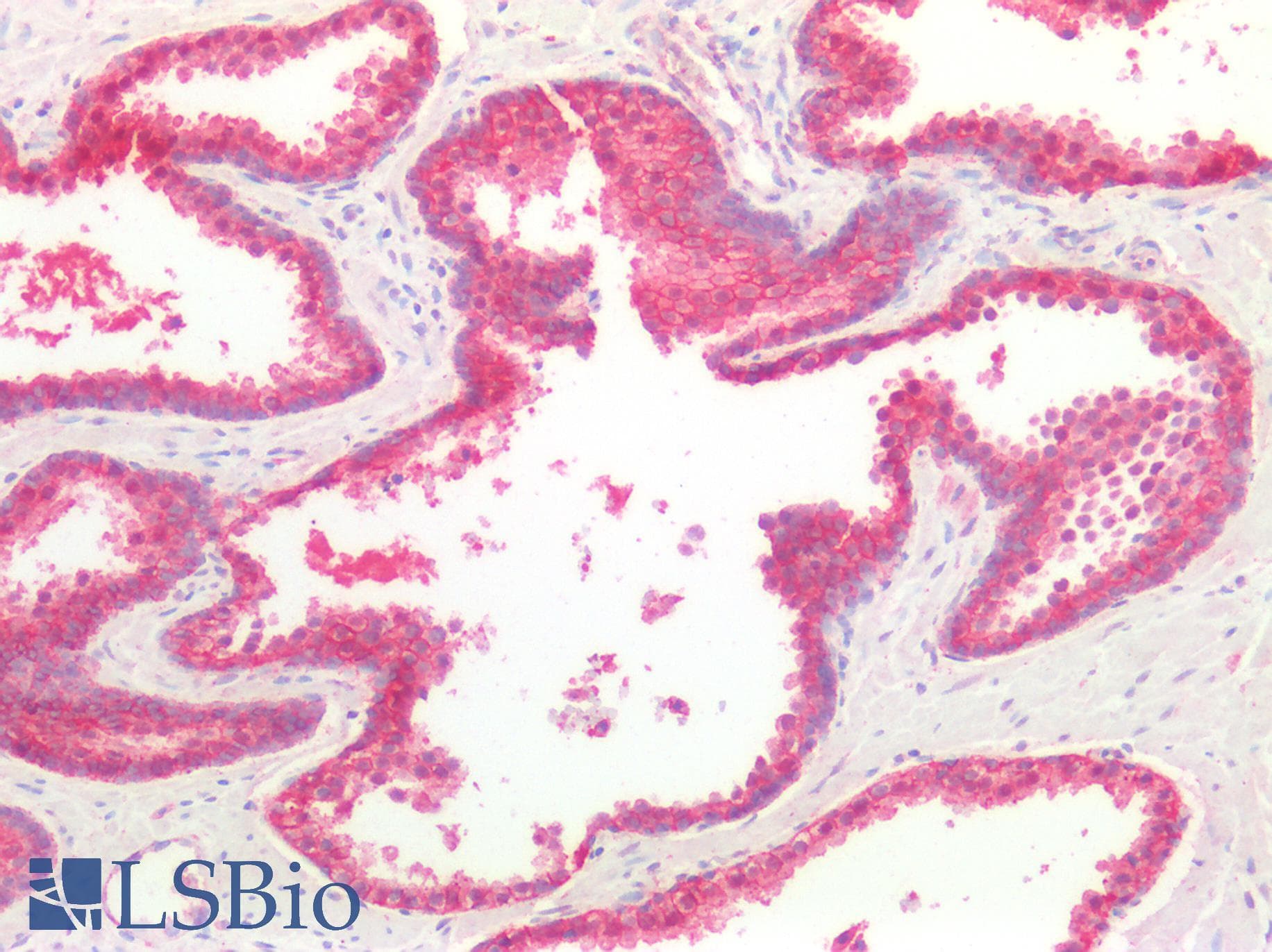 IHC-plus™ CTNNB1 / Beta Catenin Antibody