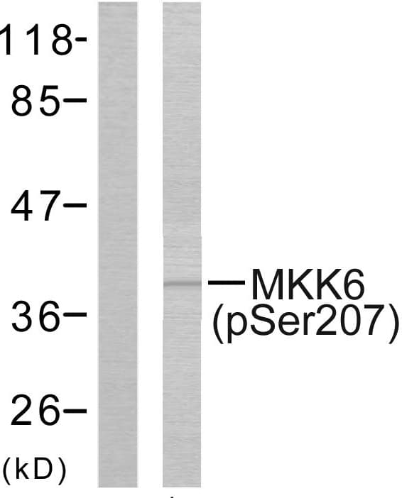 Polyclonal Rabbit anti-Human MAP2K6 / MEK6 / MKK6 Antibody (phospho-Ser207, IHC, WB)