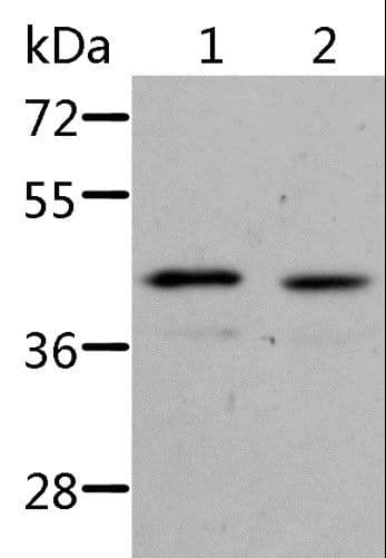 ALS2CR1 / NIF3L1 Antibody