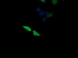 Monoclonal Mouse anti-Human MAP2K3 / MEK3 / MKK3 Antibody (clone OTI6C6, IHC, IF, WB)