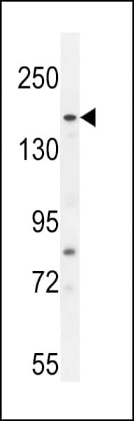 FGD6 Antibody (aa1324-1352)