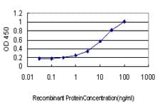 Monoclonal Mouse anti-Human ICA69 / ICA1 Antibody (clone 6G11, WB)