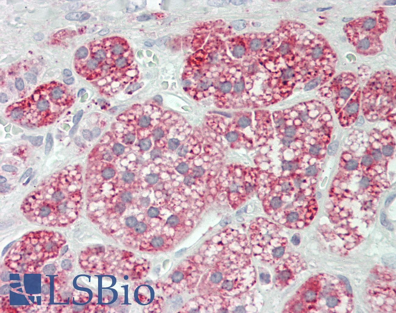 IHC-plus™ GLA / Alpha Galactosidase Antibody