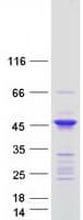 Human ANKRD63 Protein (Recombinant Myc-DDK (Flag))