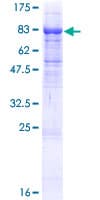 Human ITFG1 / TIP Protein (Recombinant GST)