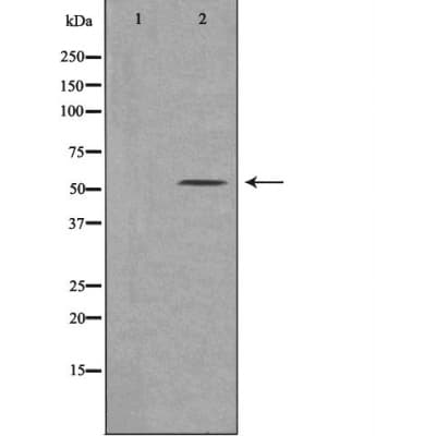 MSR1 / CD204 Antibody