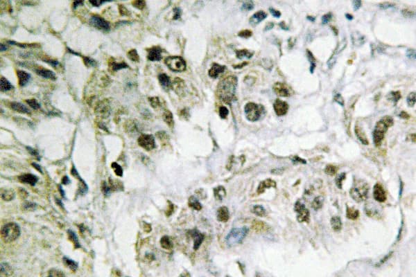 CTBP2 Antibody (Pro432)