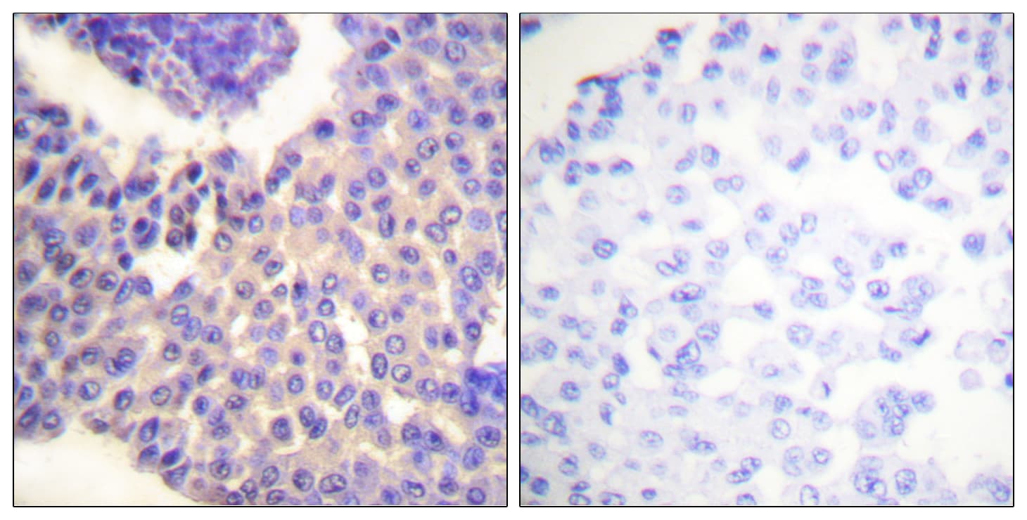 ARRB1 / Beta Arrestin 1 Antibody (phospho-Ser412)