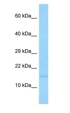 TRAPPC2 / SEDL Antibody (aa7-56)