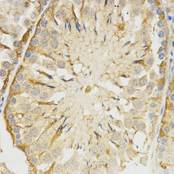 IHC-plus™ TPM2 Antibody