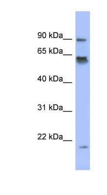 Polyclonal Rabbit anti-Human TRIP / LRRFIP1 Antibody (aa35-84, IHC, WB)