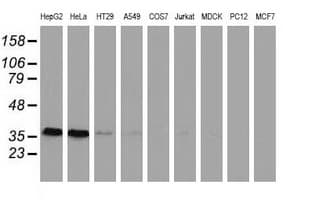 GRHPR / Glyoxylate Reductase Antibody (clone OTI1A9, Carrier-free)