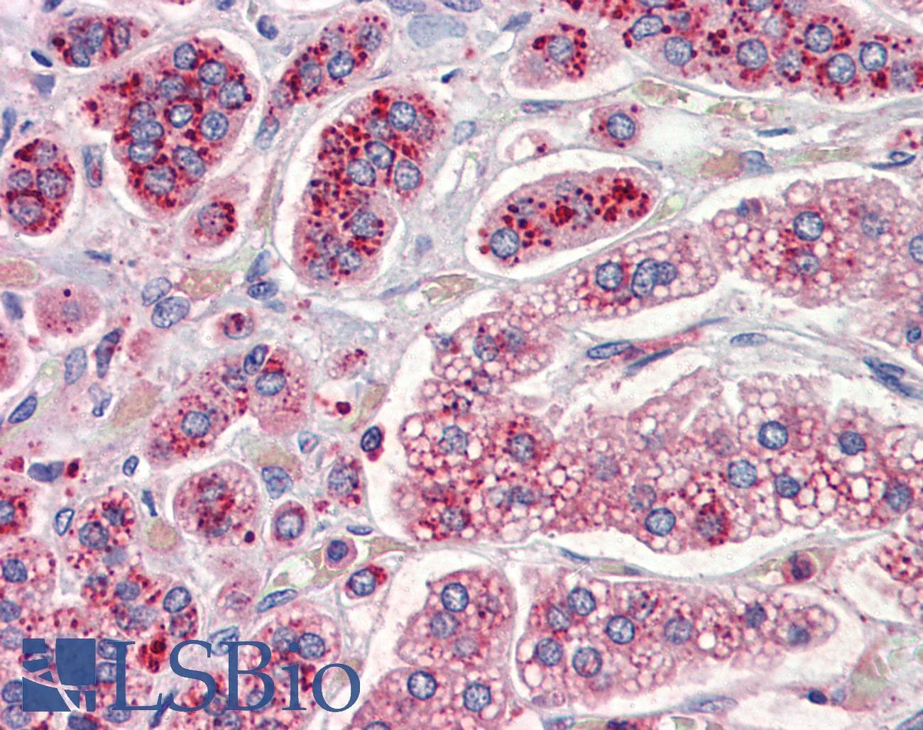 IHC-plus™ Polyclonal Rabbit anti-Human CRHR2 / CRF2 Receptor Antibody (aa10-39, IHC, WB)