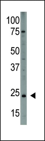PDGF-AA Antibody (aa60-89)