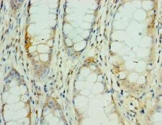 MEF2C Antibody (aa170-380)