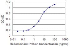 Monoclonal Mouse anti-Human CSTA / Cystatin A Antibody (clone 1A11, WB)